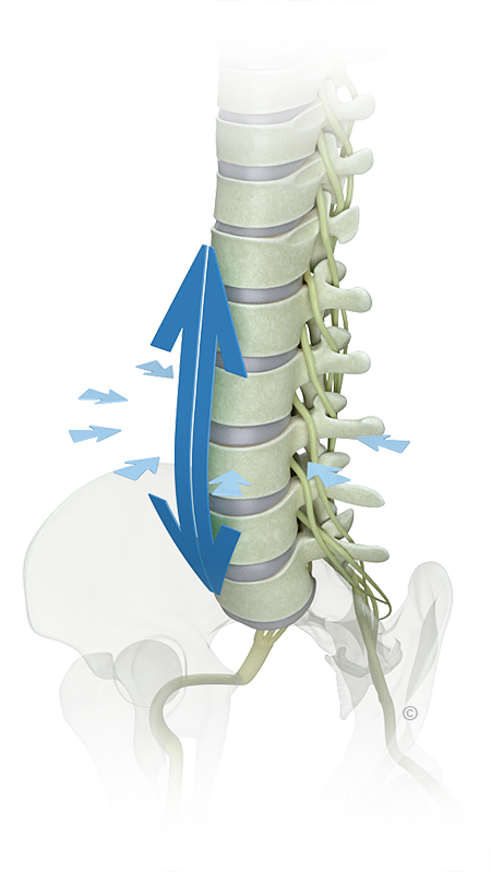 Non-Surgical Spinal Decompression Madison
